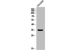 Western Blot analysis of COLO205 cells using MC1-R Polyclonal Antibody (MC1 Receptor antibody  (C-Term))