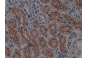 IHC-P analysis of Rat Kidney Tissue, with DAB staining. (CUBN antibody  (AA 3511-3623))