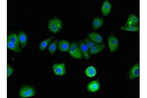 Immunofluorescent analysis of HepG2 cells using ABIN7145448 at dilution of 1:100 and Alexa Fluor 488-congugated AffiniPure Goat Anti-Rabbit IgG(H+L) (Arrestin 3 antibody  (AA 222-369))