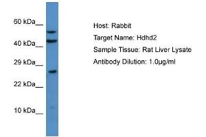 Host: Rabbit Target Name: Hdhd2 Sample Type: Rat Liver lysates Antibody Dilution: 1. (HDHD2 antibody  (N-Term))