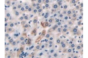 Detection of DLD in Rat Liver Tissue using Polyclonal Antibody to Dihydrolipoyl Dehydrogenase (DLD) (DLD antibody)