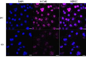 Immunocytochemical staining of HeLa cells using MCM6 antibody (ABIN7799421), 1:1,000), Top panel: wild-type (WT), Bottom panal: MCM6 shRNA knockdown (KD). (Recombinant MCM6 antibody)