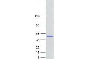 Western Blotting (WB) image for Ankyrin Repeat Domain 2 (Stretch Responsive Muscle) (ANKRD2) (Transcript Variant 2) protein (Myc-DYKDDDDK Tag) (ABIN2714704)