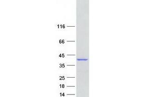 ANKRD2 Protein (Transcript Variant 2) (Myc-DYKDDDDK Tag)