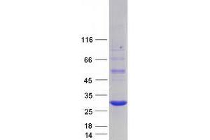 Western Blotting (WB) image for Amino-terminal Enhancer of Split (AES) (Transcript Variant 3) protein (Myc-DYKDDDDK Tag) (ABIN2714443)