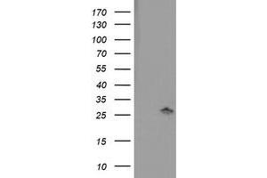 Western Blotting (WB) image for anti-Pyridoxamine 5'-Phosphate Oxidase (PNPO) antibody (ABIN1500320)