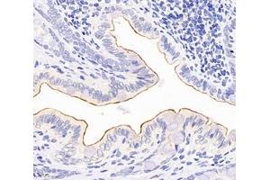 Immunohistochemistry analysis of paraffin-embedded rat colon using,TSPAN1 (ABIN7075867) at dilution of 1: 4000 (TSPAN1 antibody)