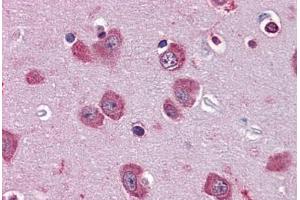 Human Brain, Cortex: Formalin-Fixed, Paraffin-Embedded (FFPE) (PER2 antibody  (AA 1-101))