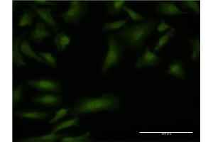 Immunofluorescence of monoclonal antibody to BOLL on HeLa cell. (BOLL antibody  (AA 185-283))