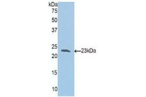 Western blot analysis of recombinant Human Slit1. (SLIT1 antibody  (AA 647-835))