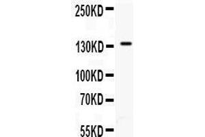 Anti- CD62P antibody, Western blotting All lanes: Anti CD62P  at 0. (P-Selectin antibody  (N-Term))