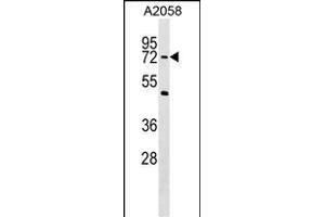 PHF19 Antibody (C-term) (ABIN1537403 and ABIN2849281) western blot analysis in  cell line lysates (35 μg/lane). (PHF19 antibody  (C-Term))