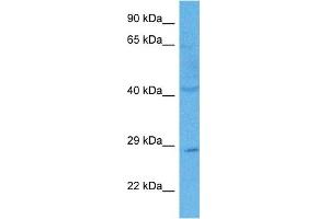 Host:  Rabbit  Target Name:  C21ORF58  Sample Tissue:  Human PANC1 Whole Cell lysates  Antibody Dilution:  1ug/ml (C21orf58 antibody  (N-Term))
