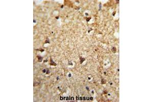 Formalin-fixed and paraffin-embedded human brain tissue reacted with EIF2A Antibody (Center), which was peroxidase-conjugated to the secondary antibody, followed by DAB staining.