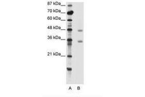 Image no. 1 for anti-Chromobox Homolog 8 (CBX8) (C-Term) antibody (ABIN202404)