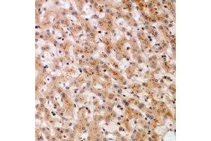 Immunohistochemical analysis of SOCS2 staining in human liver formalin fixed paraffin embedded tissue section. (SOCS2 antibody)