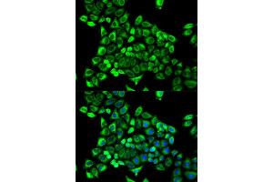 Immunofluorescence analysis of MCF-7 cells using CDA antibody (ABIN5971047).