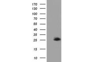 HEK293T cells were transfected with the pCMV6-ENTRY control (Left lane) or pCMV6-ENTRY AK3 (Right lane) cDNA for 48 hrs and lysed. (Adenylate Kinase 3 antibody)