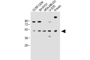 All lanes : Anti-EDIL3 Antibody (Center) at 1:1000 dilution Lane 1: CCRF-CEM whole cell lysate Lane 2: SH-SY5Y whole cell lysate Lane 3: MDA-MB-231 whole cell lysate Lane 4: U-2OS whole cell lysate Lane 5: Rat brain whole lysate Lysates/proteins at 20 μg per lane. (EDIL3 antibody  (AA 337-365))