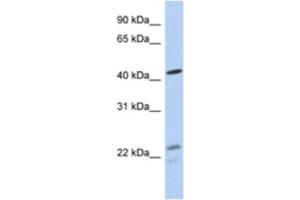 Western Blotting (WB) image for anti-Branched Chain Keto Acid Dehydrogenase E1, alpha Polypeptide (BCKDHA) antibody (ABIN2463953)