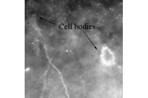 Image no. 2 for anti-Calcium/calmodulin-Dependent Protein Kinase II beta (CAMK2B) (AA 499-513) antibody (ABIN221188)