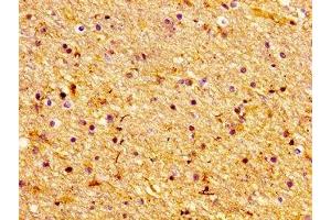 Immunohistochemistry of paraffin-embedded human brain tissue using ABIN7147463 at dilution of 1:100 (LASS1 antibody  (AA 1-52))