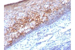 Formalin-fixed, paraffin-embedded human Tonsil stained with MCAM Mouse Monoclonal Antibody (MCAM/1101). (MCAM antibody)