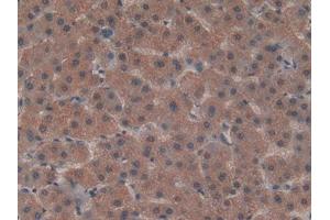 DAB staining on IHC-P; Samples: Human Liver Tissue (LRP5L antibody  (AA 7-238))