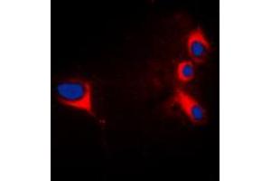 Immunofluorescent analysis of cTnI staining in HepG2 cells. (TNNI3 antibody  (N-Term))