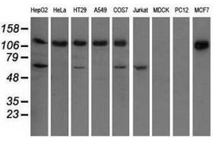 Image no. 2 for anti-Insulin-Like Growth Factor 2 mRNA Binding Protein 2 (IGF2BP2) antibody (ABIN1498824) (IGF2BP2 antibody)