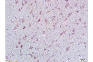 Formalin-fixed and paraffin embedded rat brain labeled with Rabbit Anti STMN2/SCG10 Polyclonal Antibody, Unconjugated  at 1:200 followed by conjugation to the secondary antibody and DAB staining (STMN2 antibody  (AA 8-100))