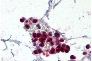 Human Colon, Neutrophils (formalin-fixed, paraffin-embedded) stained with NCF1 antibody ABIN337093 at 5 ug/ml followed by biotinylated anti-goat IgG secondary antibody ABIN481715, alkaline phosphatase-streptavidin and chromogen. (NCF1 antibody  (AA 378-390))