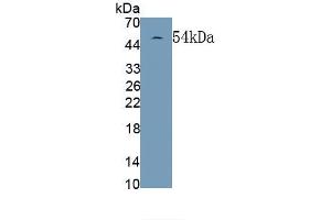 Detection of Recombinant GFAP, Rat using Monoclonal Antibody to Glial Fibrillary Acidic Protein (GFAP) (GFAP antibody  (AA 1-430))