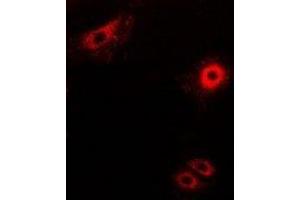 Immunofluorescent analysis of Secretogranin-2 staining in MCF7 cells.
