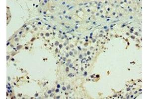 Immunohistochemistry of paraffin-embedded human testis tissue using ABIN7161904 at dilution of 1:100 (TR4 antibody  (AA 240-380))