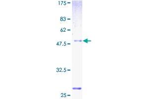 NUPL2 Protein (AA 1-224) (GST tag)