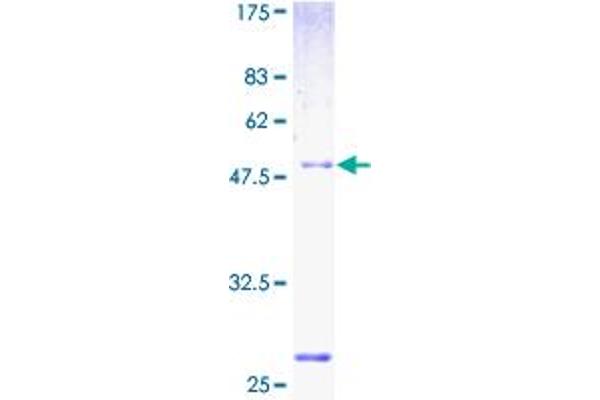 NUPL2 Protein (AA 1-224) (GST tag)