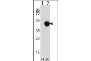 Western blot analysis of LRG1 (arrow) using rabbit polyclonal LRG1 Antibody (N-term) (ABIN652229 and ABIN2840955).