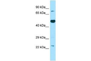 WB Suggested Anti-TBXAS1 Antibody Titration: 1. (TBXAS1 antibody  (C-Term))