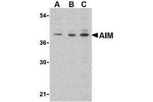 Western Blotting (WB) image for anti-CD5 Molecule-Like (CD5L) (C-Term) antibody (ABIN2472165) (CD5L antibody  (C-Term))