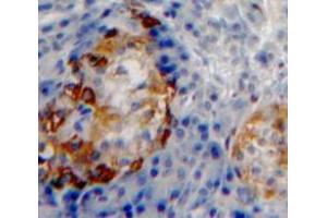 Used in DAB staining on fromalin fixed paraffin-embedded Pancreas tissue