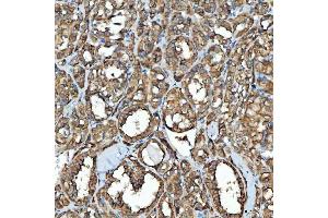 IHC analysis of SDF2L1 using anti-SDF2L1 antibody (ABIN7601111).