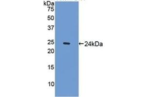 Detection of Recombinant SPRY1, Mouse using Polyclonal Antibody to Sprouty Homolog 1 (SPRY1) (SPRY1 antibody  (AA 112-303))