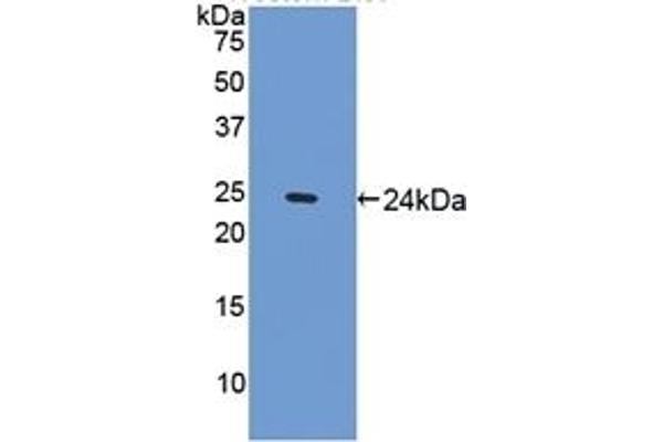 SPRY1 anticorps  (AA 112-303)