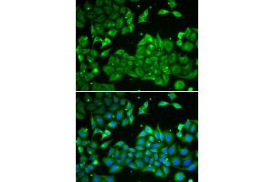 Immunofluorescence analysis of HeLa cells using ALDH3A1 antibody (ABIN6290003).