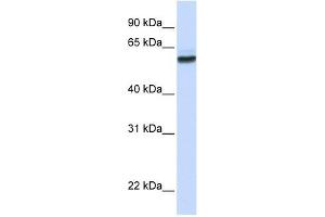 NUP62 antibody used at 1 ug/ml to detect target protein. (NUP62 antibody  (N-Term))