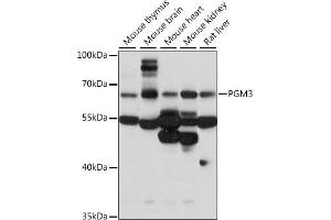 Western blot analysis of extracts of various cell lines, using PGM3 antibody (ABIN7269313) at 1:1000 dilution. (Phosphoglucomutase 3 antibody  (AA 1-300))