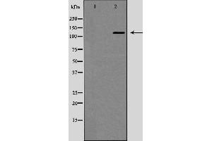 Western blot analysis of JAK1 expression in EGF treated MCF7 whole cell lysates,The lane on the left is treated with the antigen-specific peptide. (JAK1 antibody)