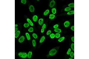 Immunofluorescence Analysis of PFA fixed HeLa cells labeling Cyclin B1 Mouse Monoclonal Antibody (V92. (Cyclin B1 antibody)