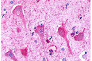 Anti-P2RY8 / P2Y8 antibody  ABIN1049224 IHC staining of human brain, neurons and glia.